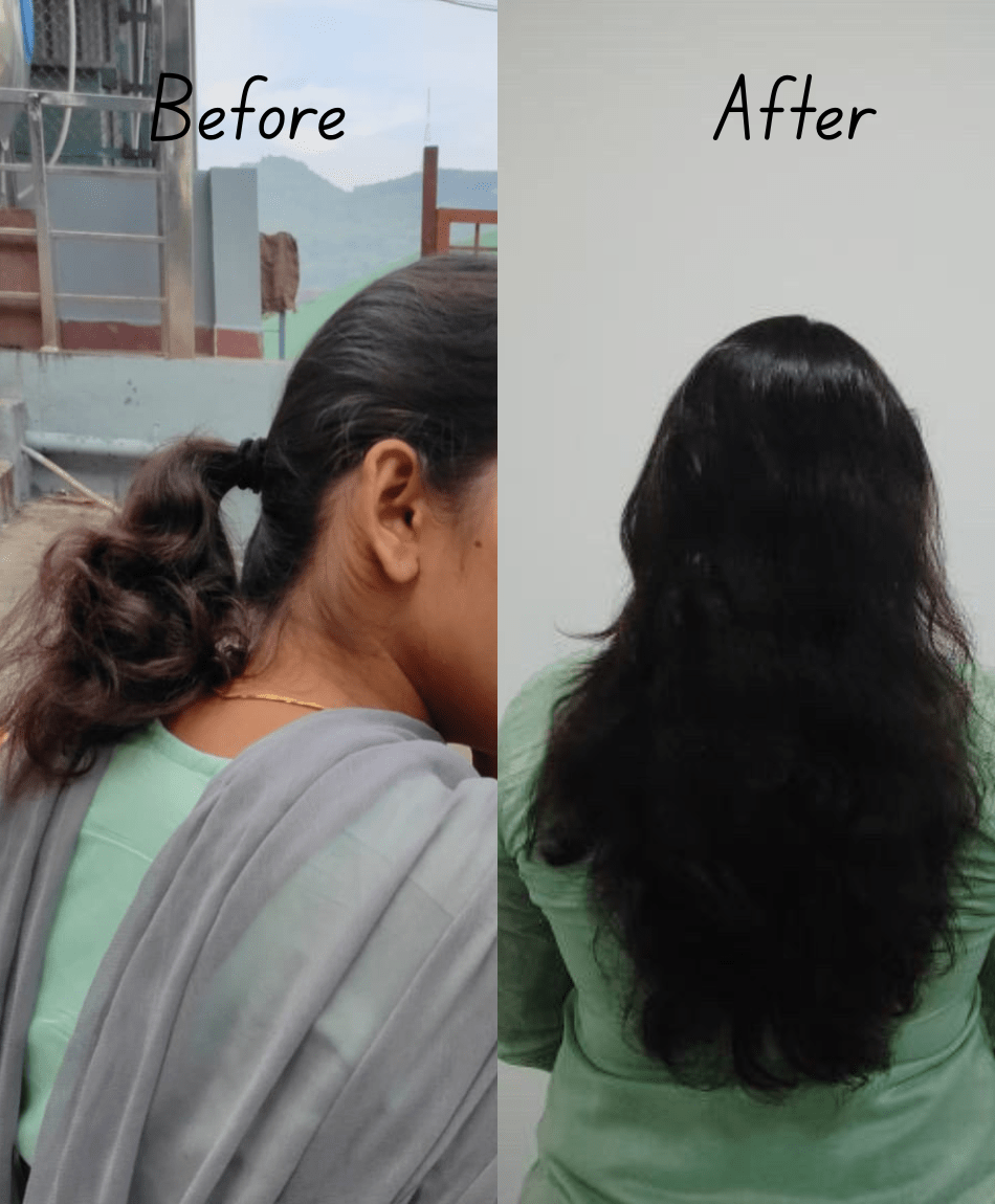 Healthy Hair Care Combo - Image 3